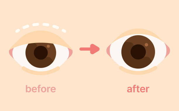 istockphoto-2194819446-612×612 Glaucoma Specialist Aizawl